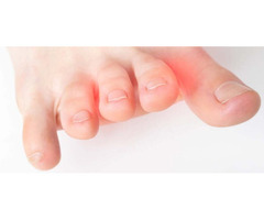 Neuroma Specialties In Florida