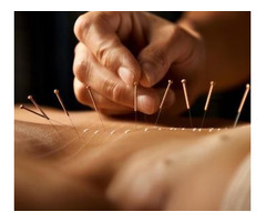 Cambridge Acupuncture Association