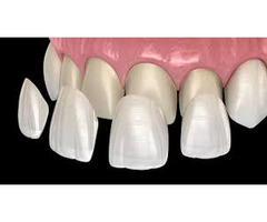 Dentures jacksonville fl